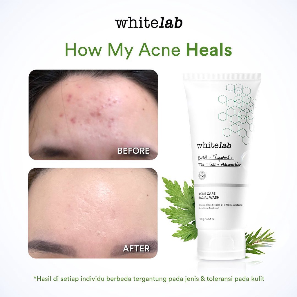 WHITELAB Acne Care Facial Wash 100gr