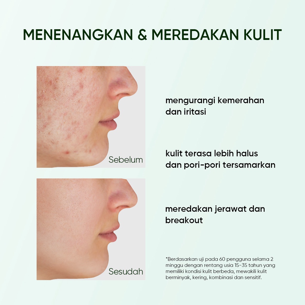 Skintific Mugwort Anti Pores & Acne Clay Stick 40gr Skintific Mugwort Anti Pores & Acne Clay Stick 40gr