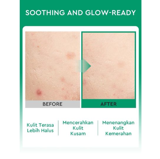 Glad 2 Glow 7% Glycolic Acid Essence Toner 100ml