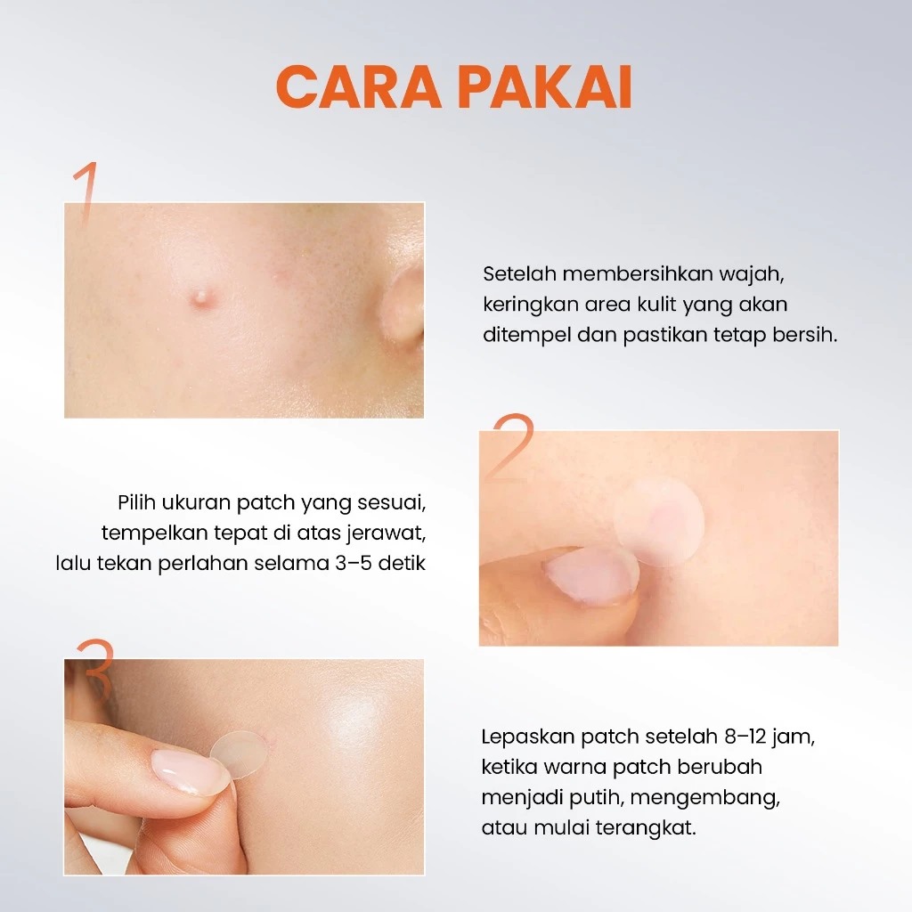 YOU Acneplus BHA Acne Patch 36pcs