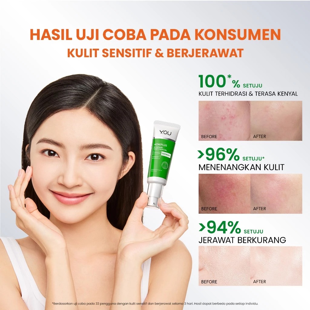 YOU Acneplus B5 Barrier Moisturizer Gel 30gr