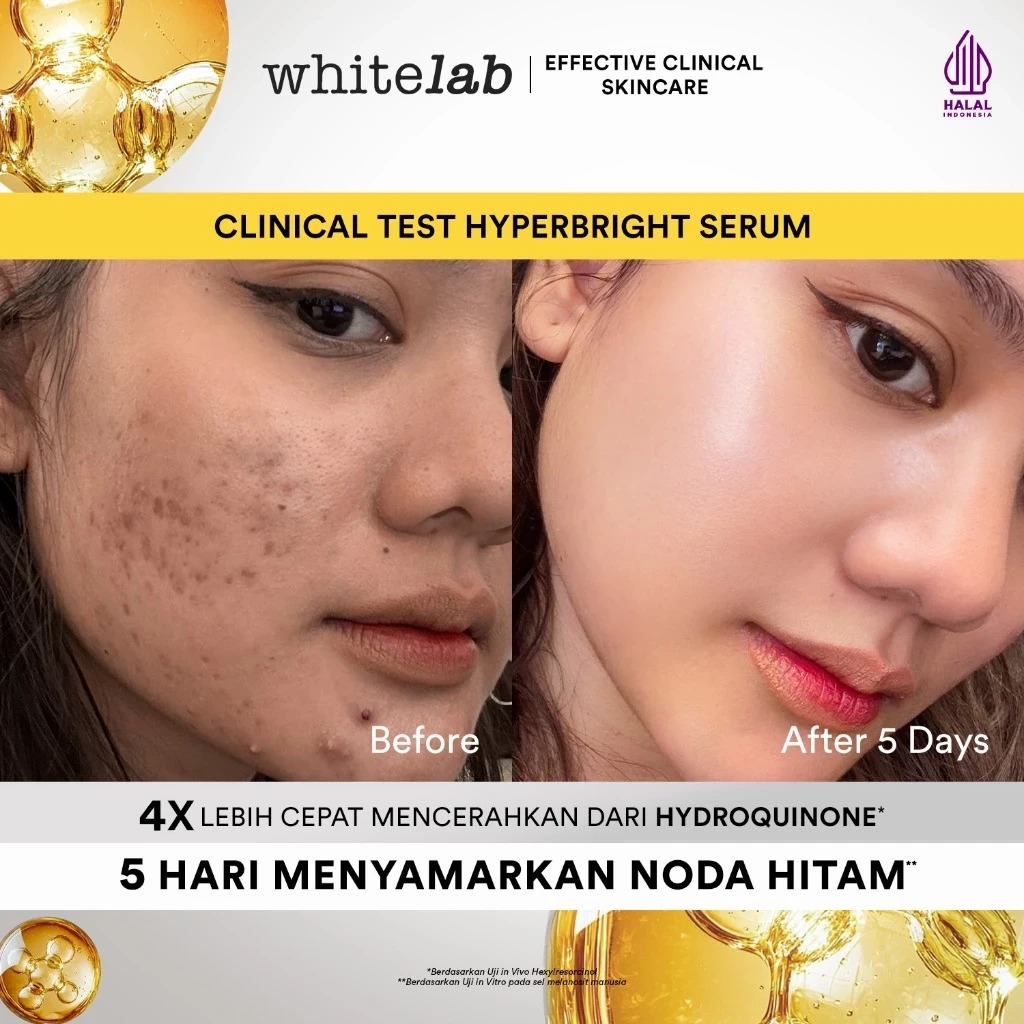 WHITELAB Hyperbright Serum 20ml
