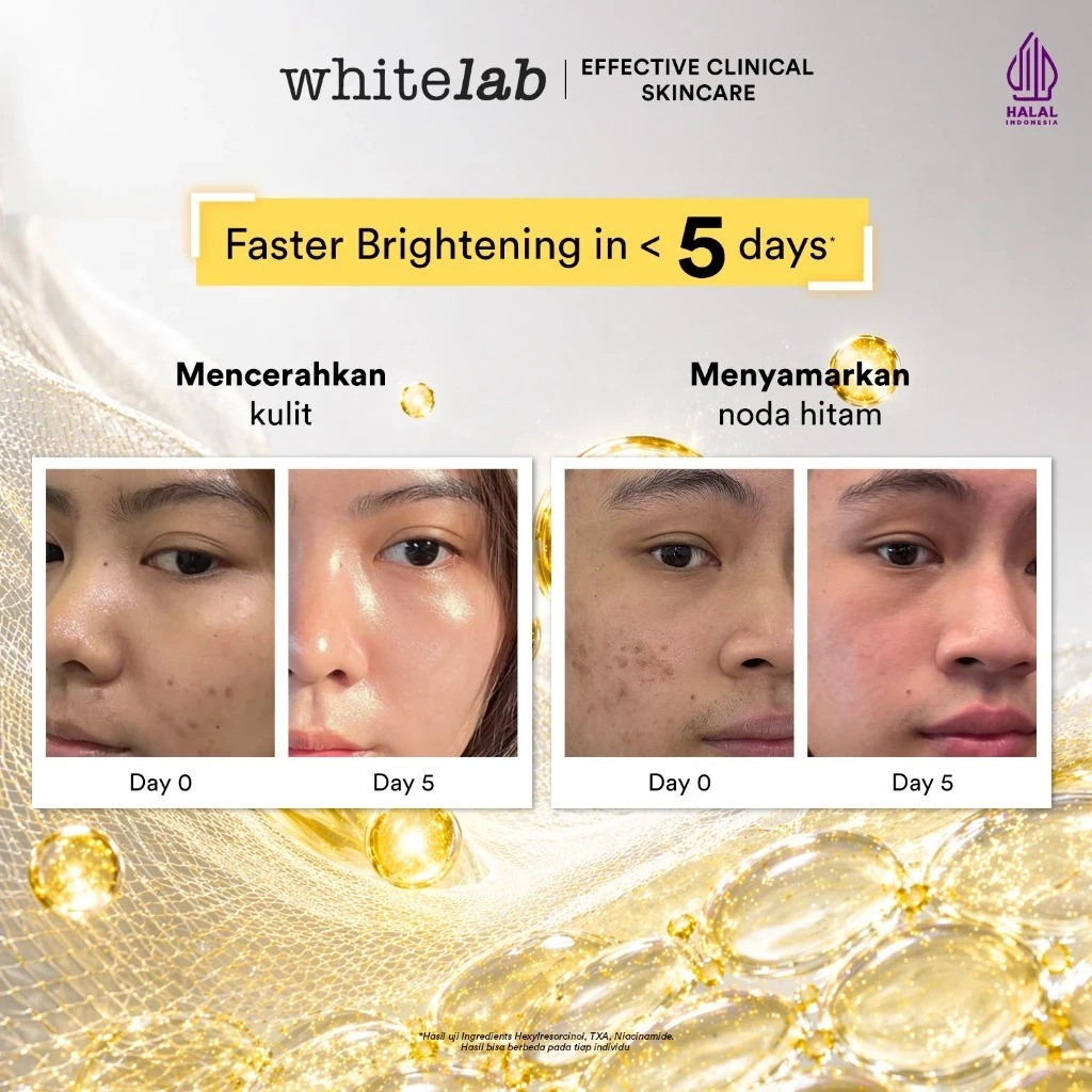 WHITELAB Hyperbright Serum 20ml