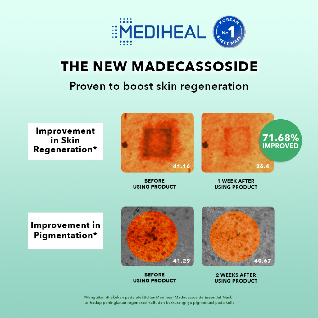 Mediheal Essential Mask - Madecassoside Soothing (Tosca) Mediheal Essential Mask - Madecassoside Soothing (Tosca)