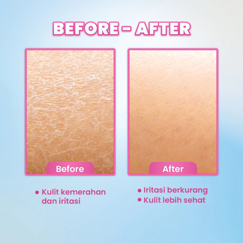 Scora 2.5% D-Panthenol Barrier Shield Moisturizer 40ml