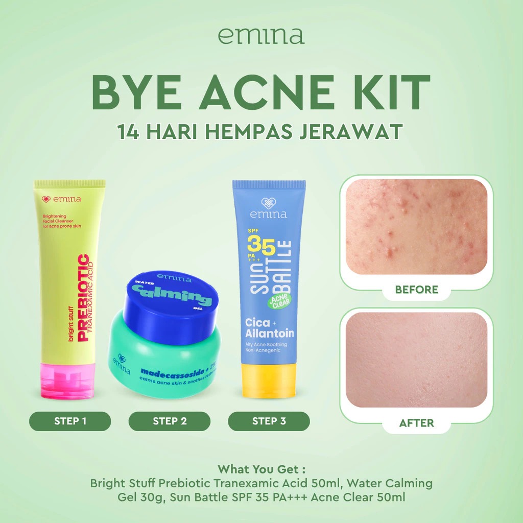 Emina Bundle 3in1 BYE ACNE KIT - (Bright Stuff For Acne FW 50ml + Sun Battle SPF35 Cica 50ml + Water Calming Gel 30gr)