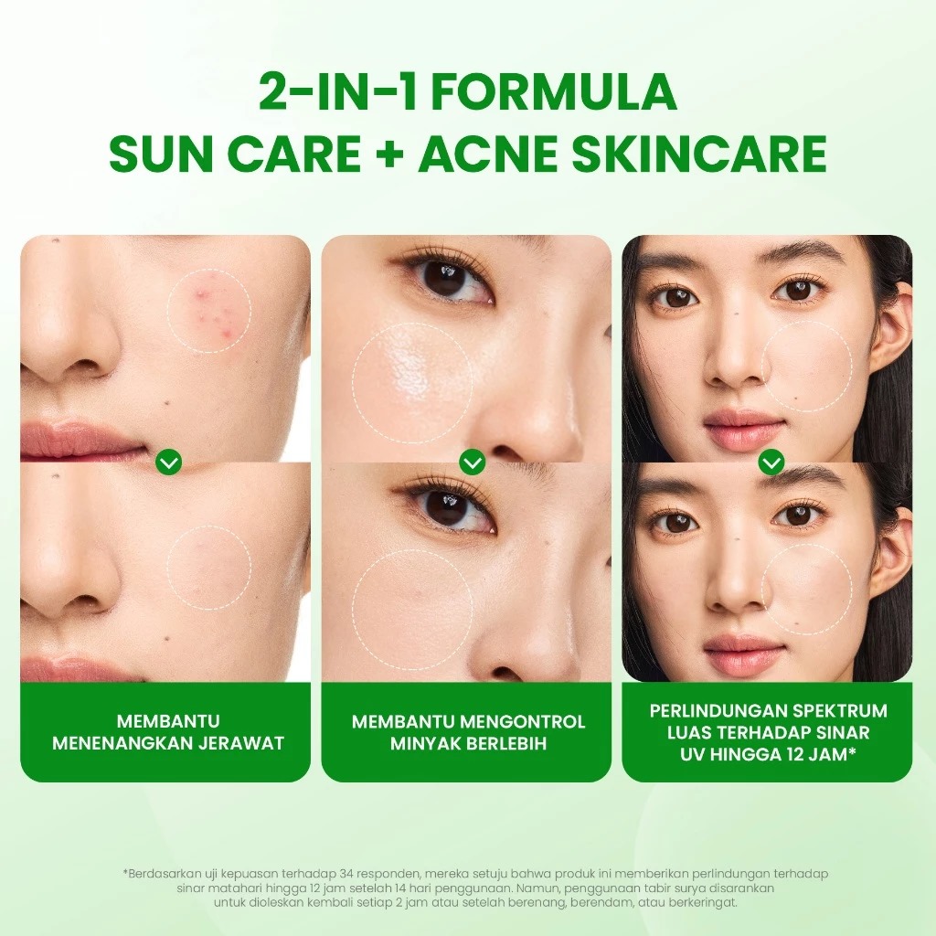 YOU Sunbrella Acne Shield Light Sunscreen SPF40+ PA++++ 30gr