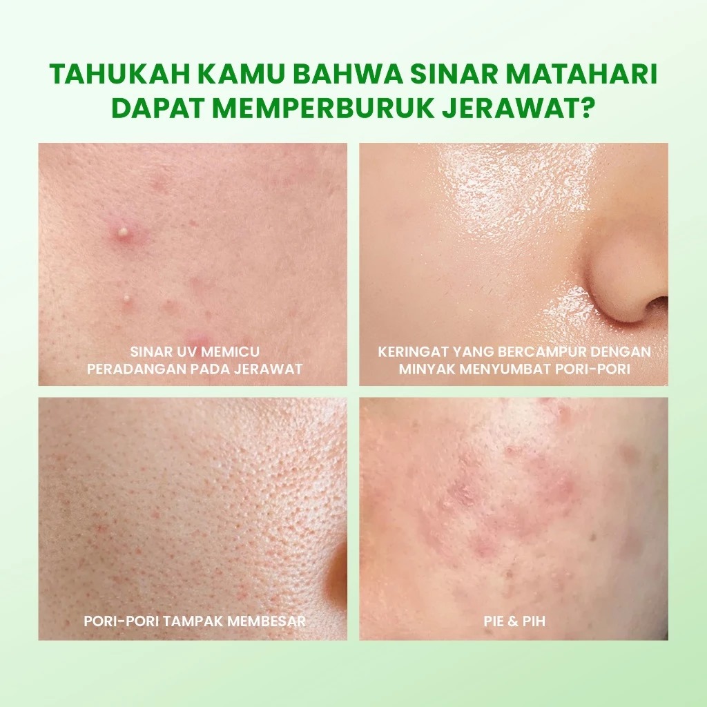 YOU Sunbrella Acne Shield Light Sunscreen SPF40+ PA++++ 30gr