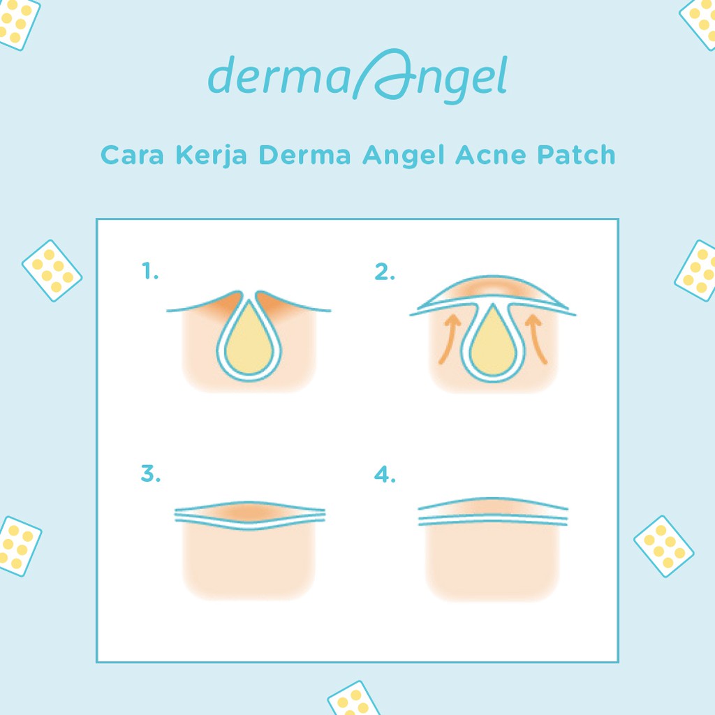 DERMA ANGEL Acne Patch Mix 18s (Day 12s Night 6s) DERMA ANGEL Acne Patch Mix 18s (Day 12s Night 6s)