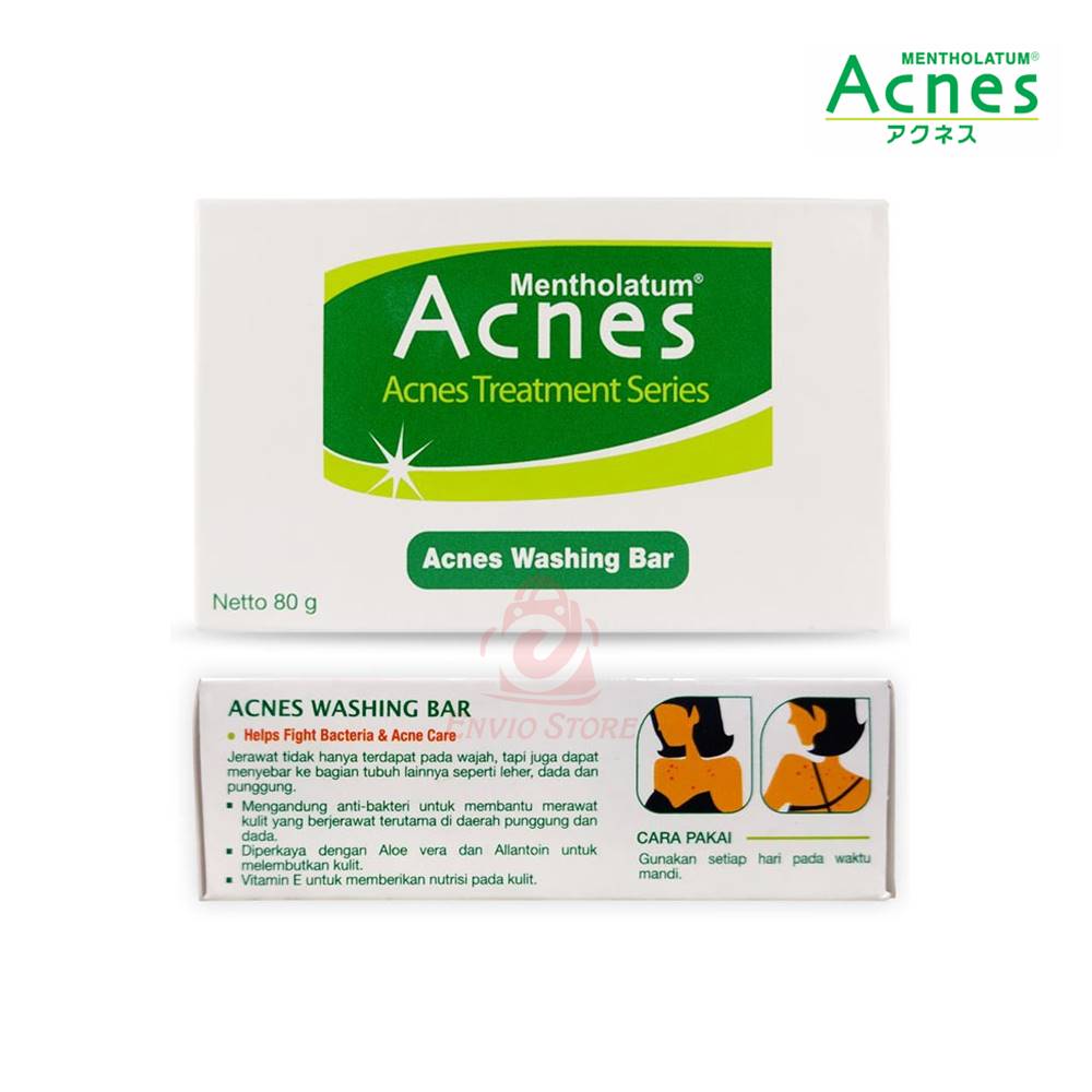 ACNES Washing Bar 80gr (Sabun Batang) ACNES Washing Bar 80gr (Sabun Batang)