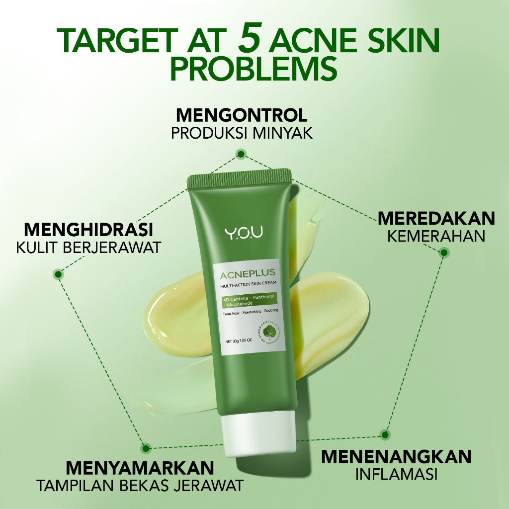 YOU Acneplus Multi Action Skin Cream 30gr *