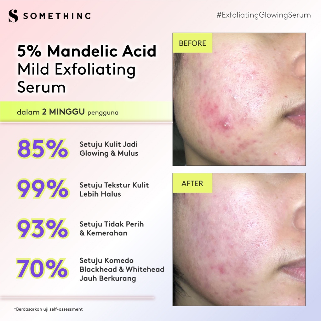 Somethinc 5% Mandelic Acid Mild Exfoliating Serum 20ml