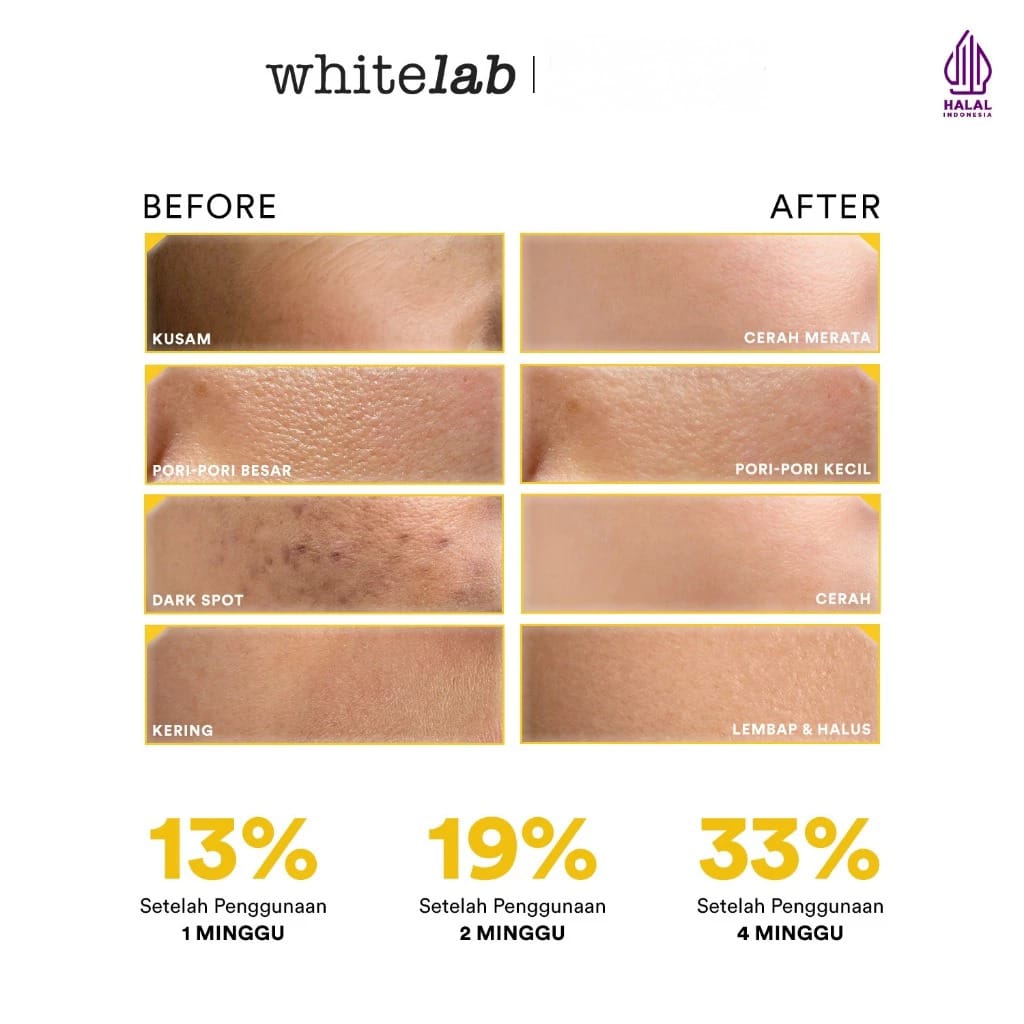 WHITELAB N-Dose+ Intense Brightening Facial Wash 100ml