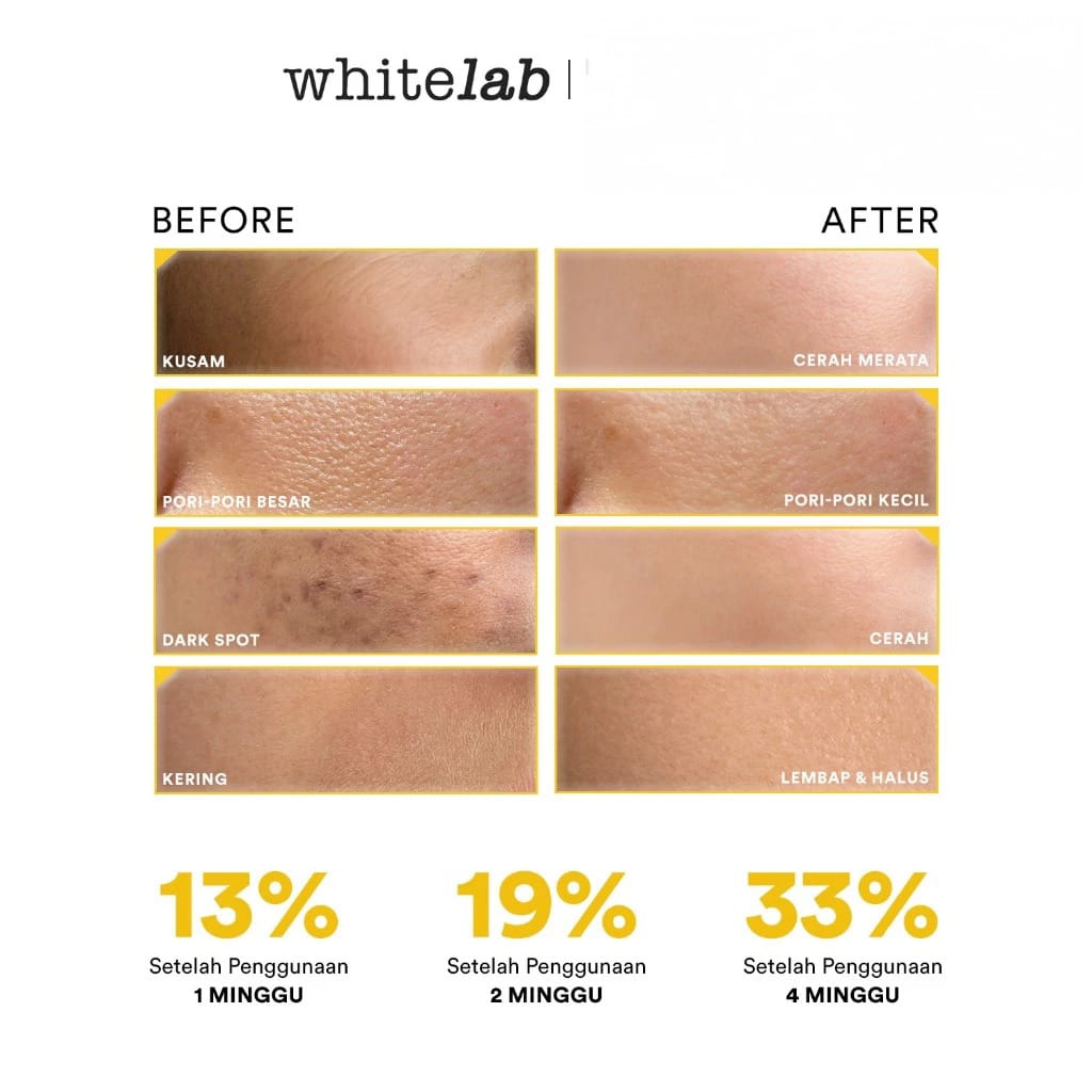 WHITELAB N-Dose+ Intense Brightening Essence Toner 100ml