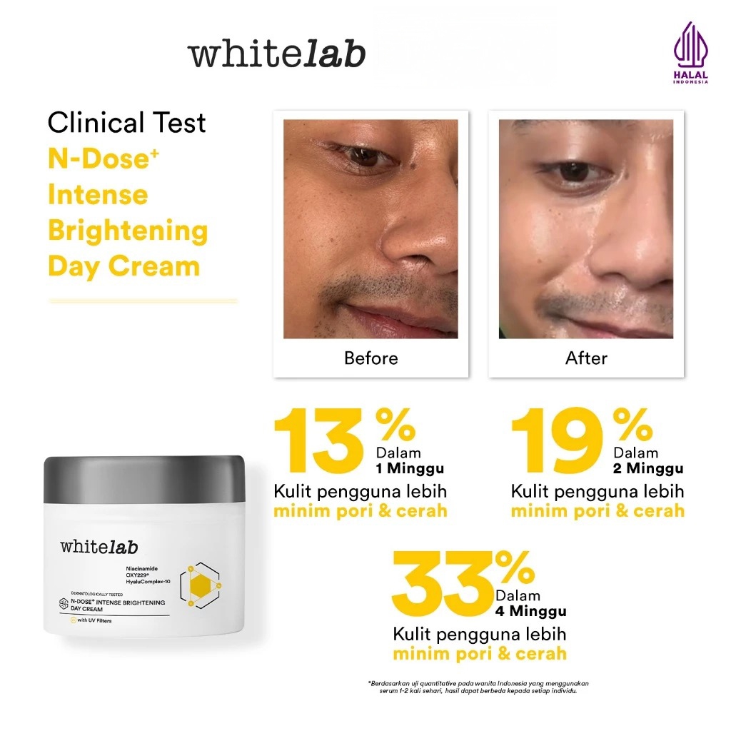 WHITELAB N-Dose+ Intense Brightening Day Cream 20gr