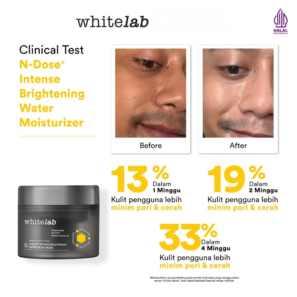 WHITELAB N-Dose+ Intense Brightening Water Moisturizer 20gr
