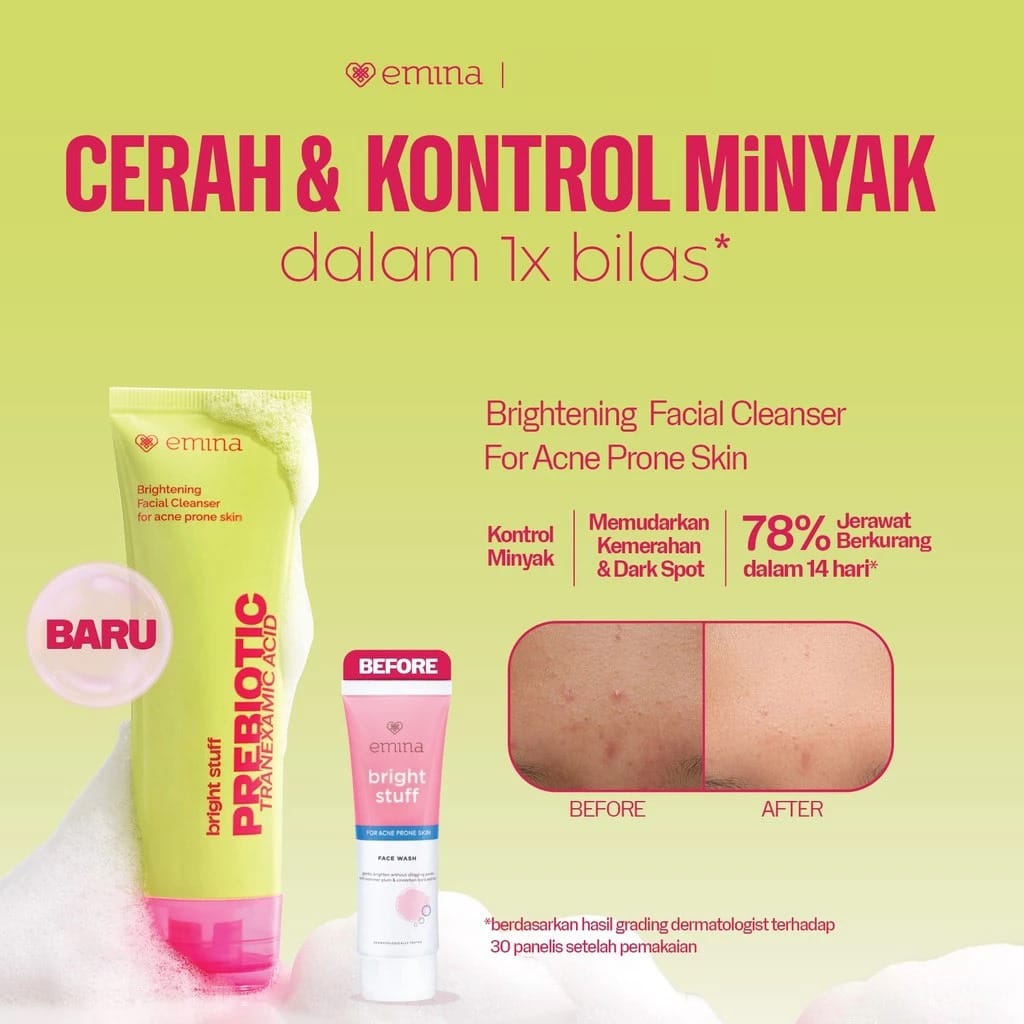 Emina Bright Stuff for Acne Prone Skin Prebiotic Tranexamic Acid Face Wash 100ml Emina Bright Stuff for Acne Prone Skin Prebiotic Tranexamic Acid Face Wash 100ml