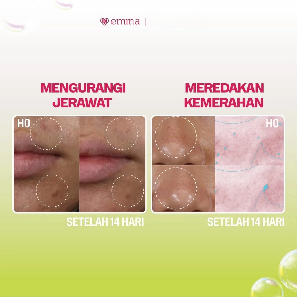 Emina Bright Stuff for Acne Prone Skin Prebiotic Tranexamic Acid Face Wash 100ml Emina Bright Stuff for Acne Prone Skin Prebiotic Tranexamic Acid Face Wash 100ml