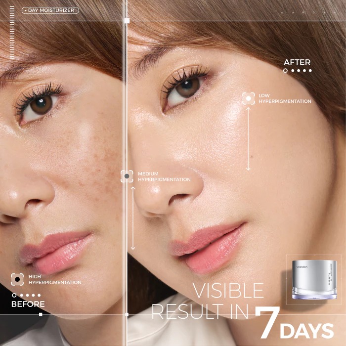 Wardah Crystal Secret Alpha Arbutin 5% Niacinamide SPF 35 PA+++ Day Moisturizer 30gr