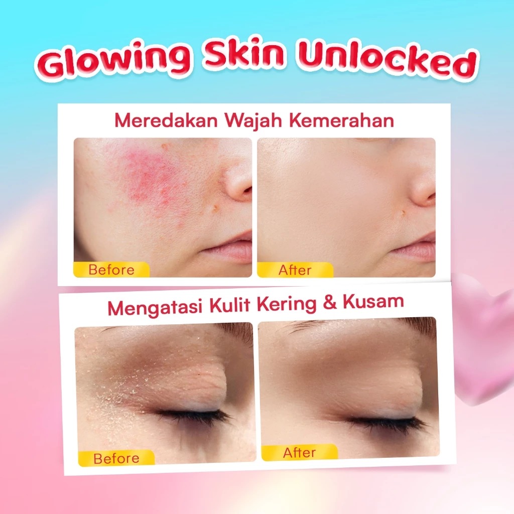 Glowsophy Cica Glow Snail Moisturizer 30ml