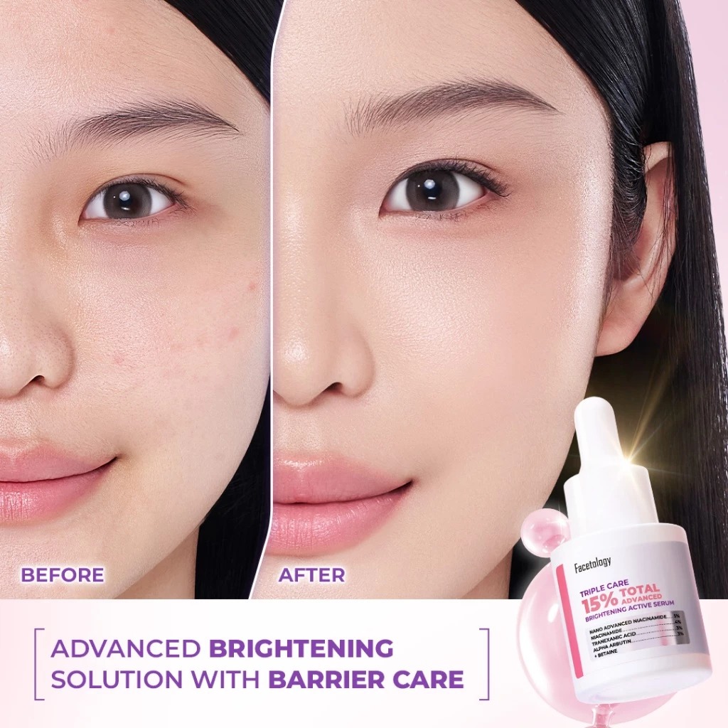 Facetology Triple Care Serum 15ml - 15% Total Advanced Brightening Active Serum