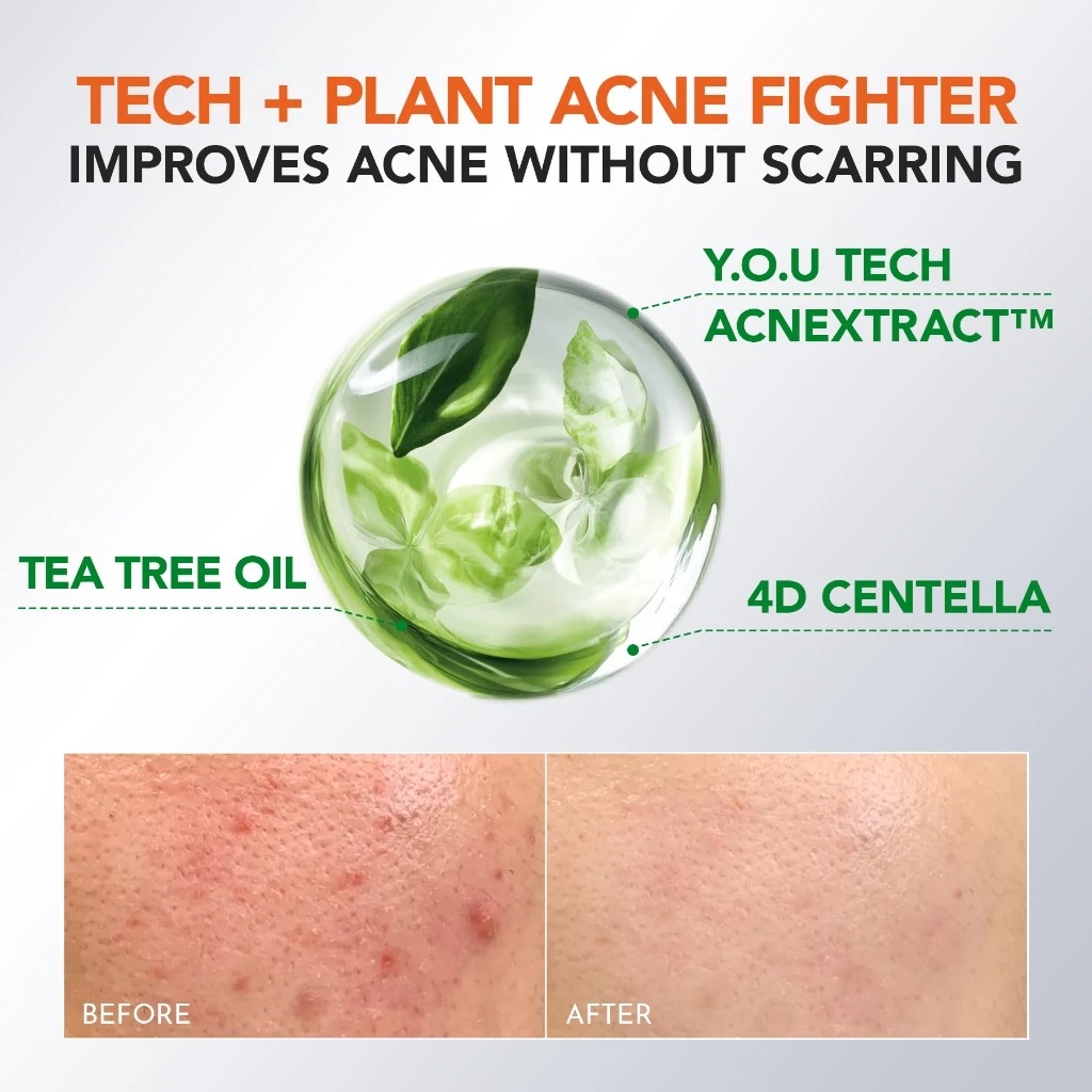 YOU Acneplus 2% BHA Fight Acne Serum 20ml