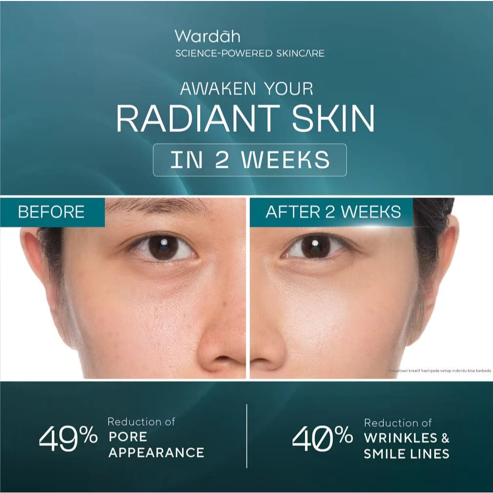 Wardah Radiant Resurfacing Retinal Cysteamine Serum 30ml