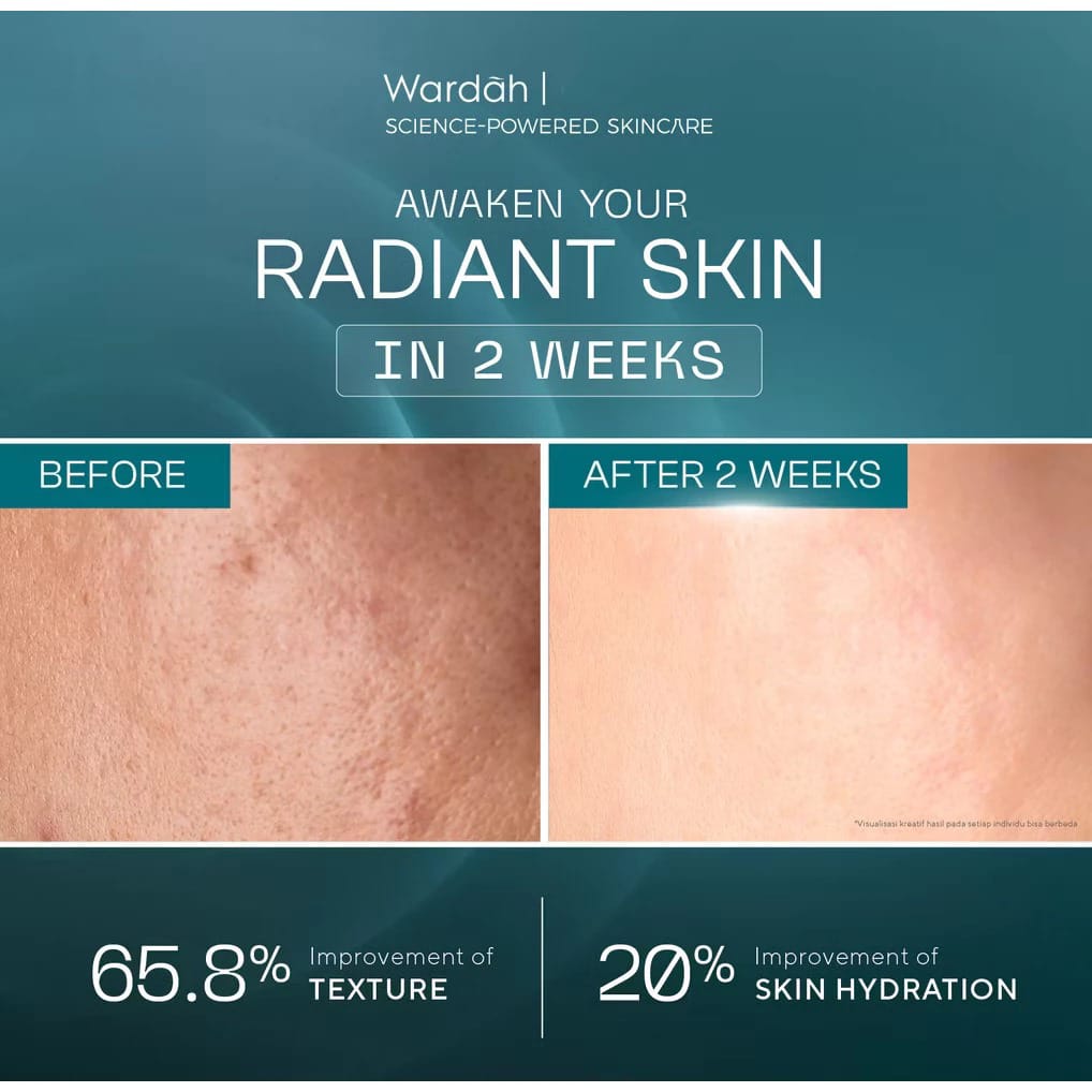 Wardah Exosome + PDRN Lift Regenerating Serum 30ml