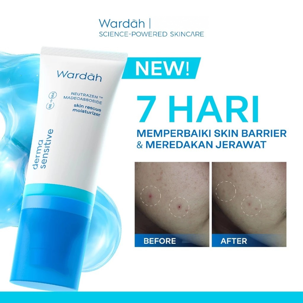 Wardah Derma Sensitive Skin Rescue Moisturizer 50gr