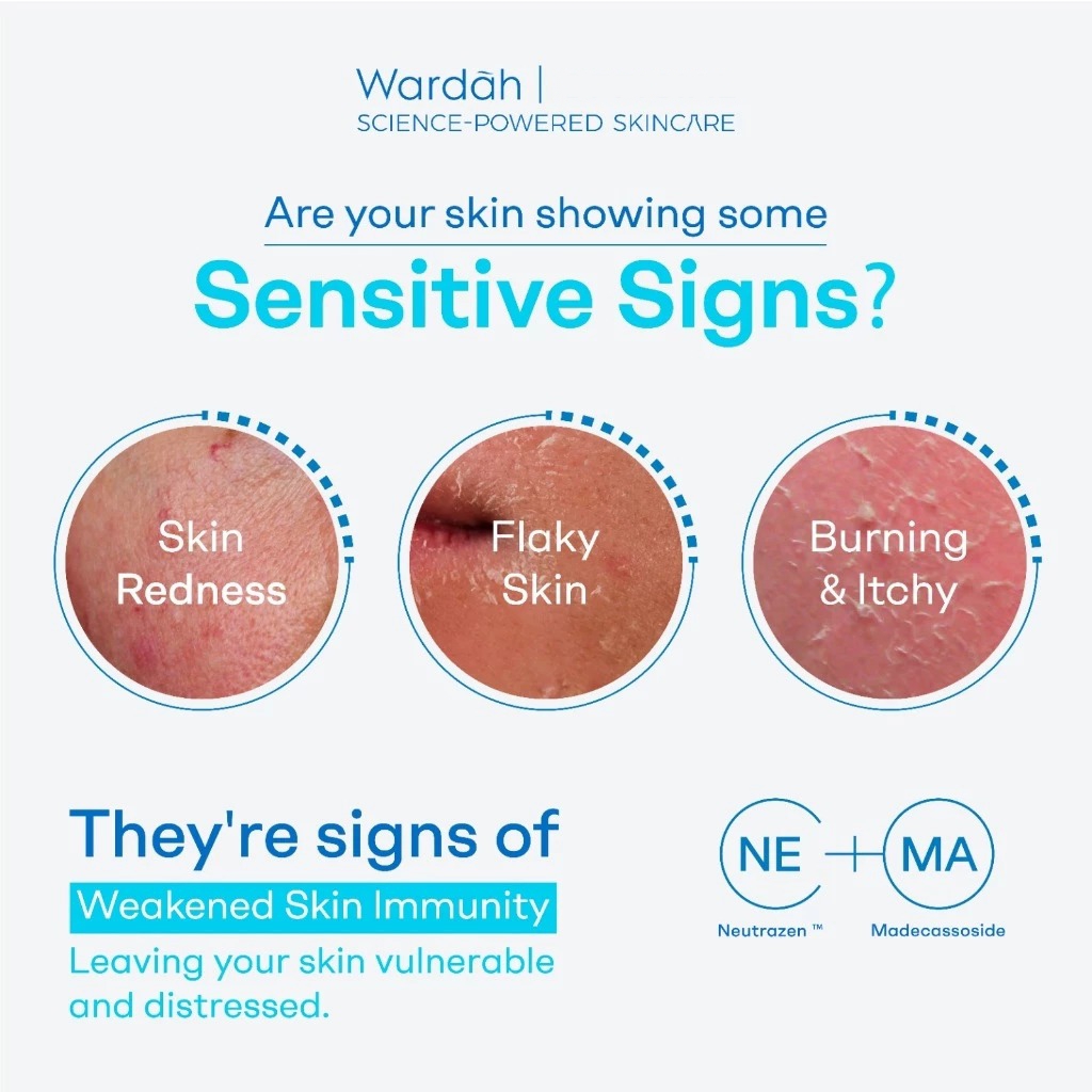 Wardah Derma Sensitive Skin Rescue Moisturizer 50gr