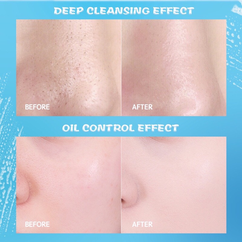 YOU Hy! Amino Contr-Oil Oil Control Facial Wash 50gr (Biru)