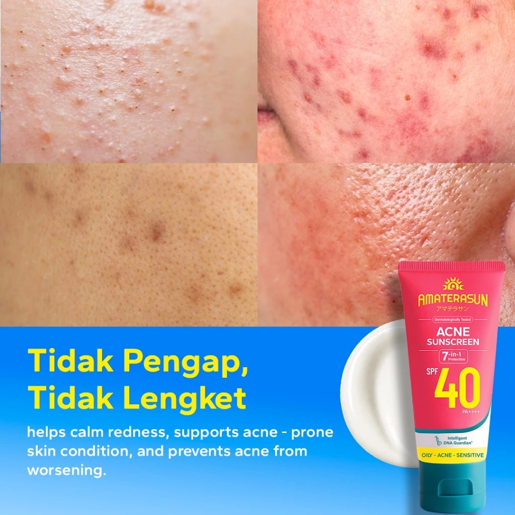 Amaterasun Acne Sunscreen SPF40 PA++++ 40gr