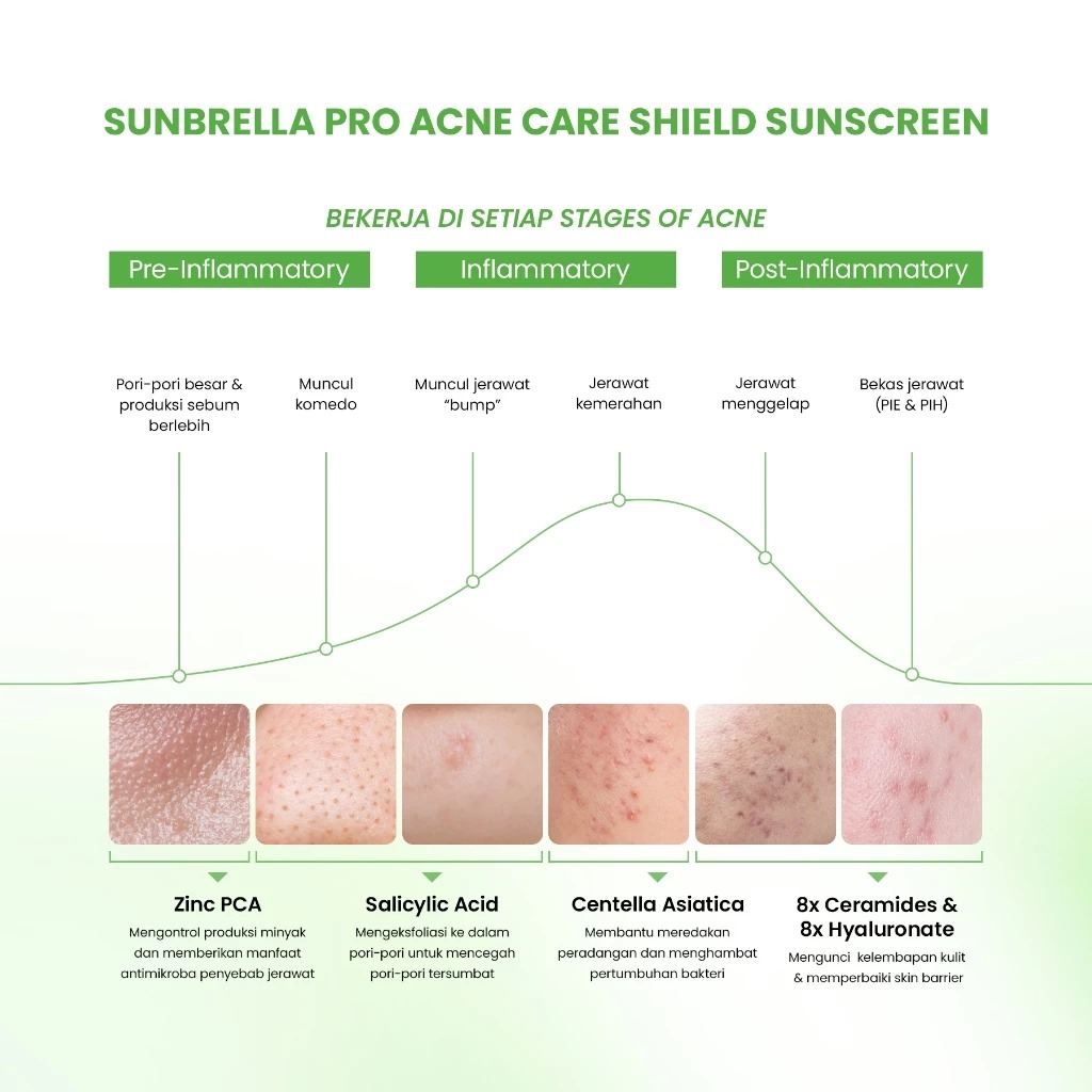 YOU Sunbrella Pro Acnecare Shield Sunscreen SPF50+ PA++++ 30ml