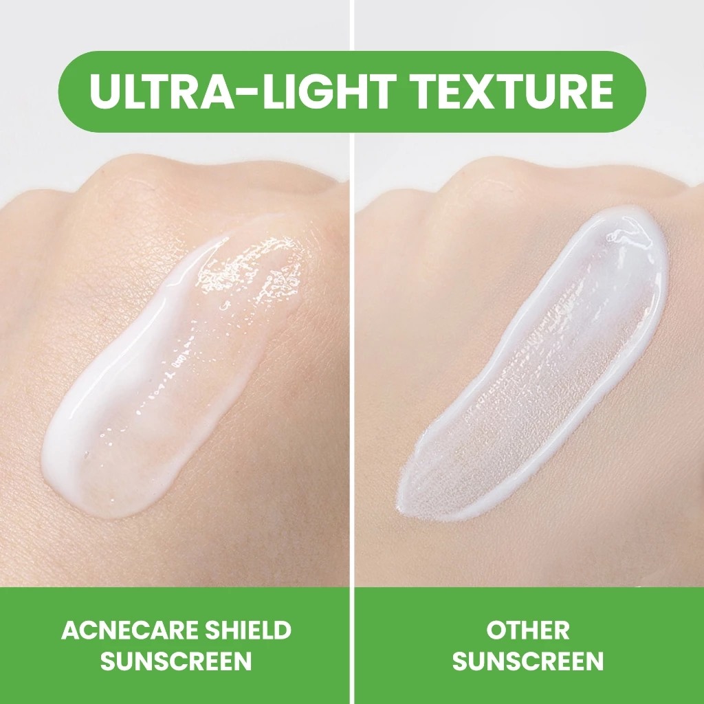 YOU Sunbrella Pro Acnecare Shield Sunscreen SPF50+ PA++++ 30ml