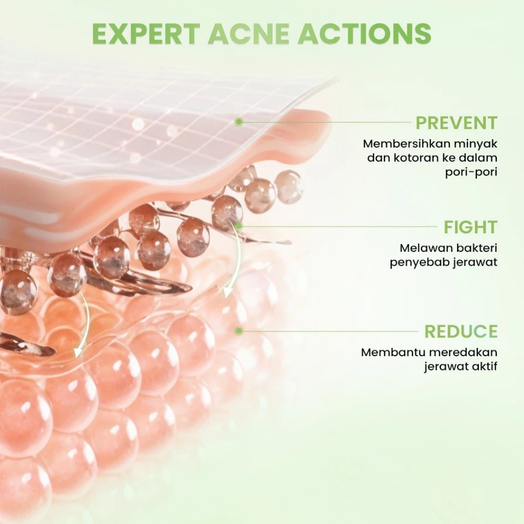 Hanasui Acne Expert Spot Gel 10X Calming & Oil Balancing Essence 15gr