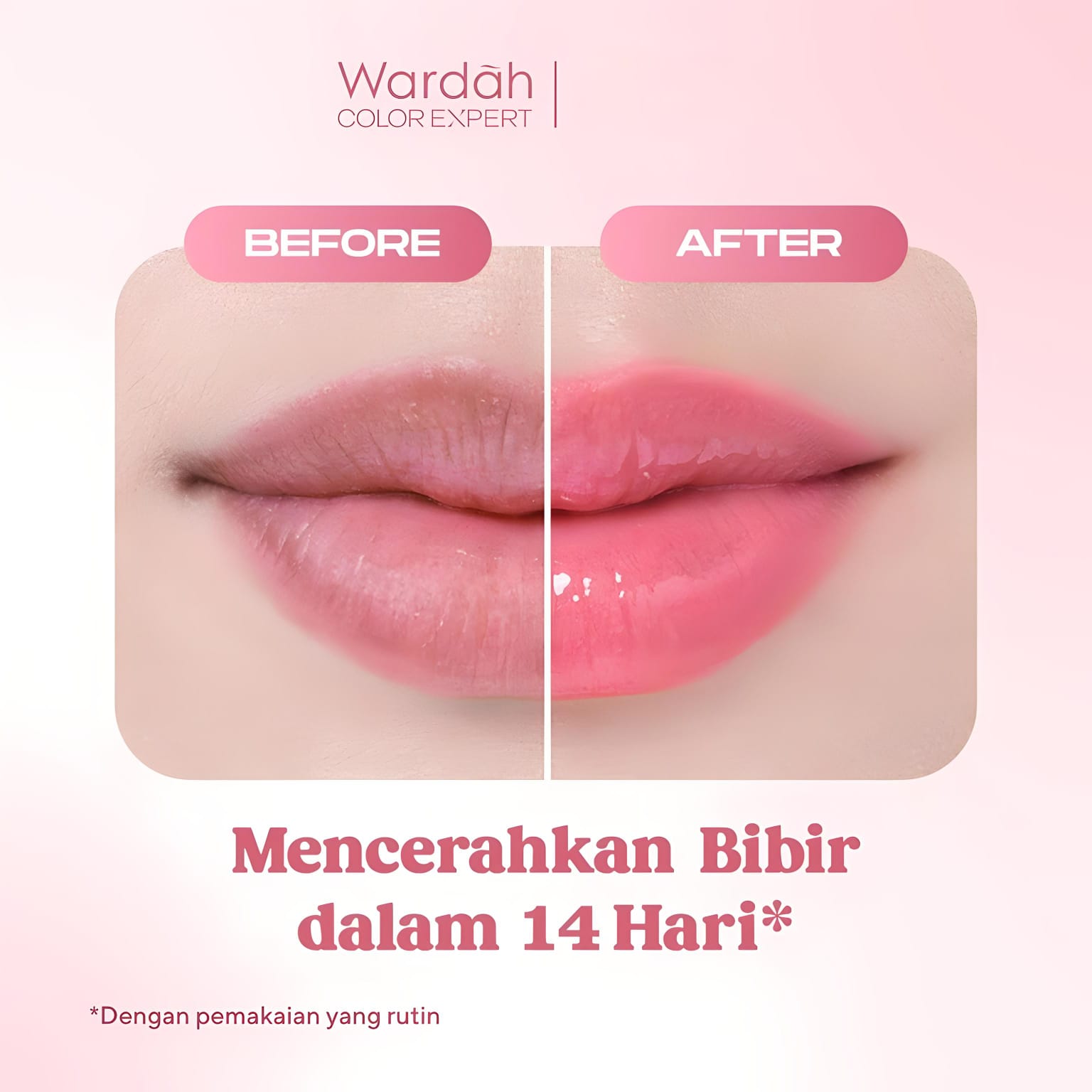 Wardah Lip Rescue Jelly Balm Dusty Rose 7gr