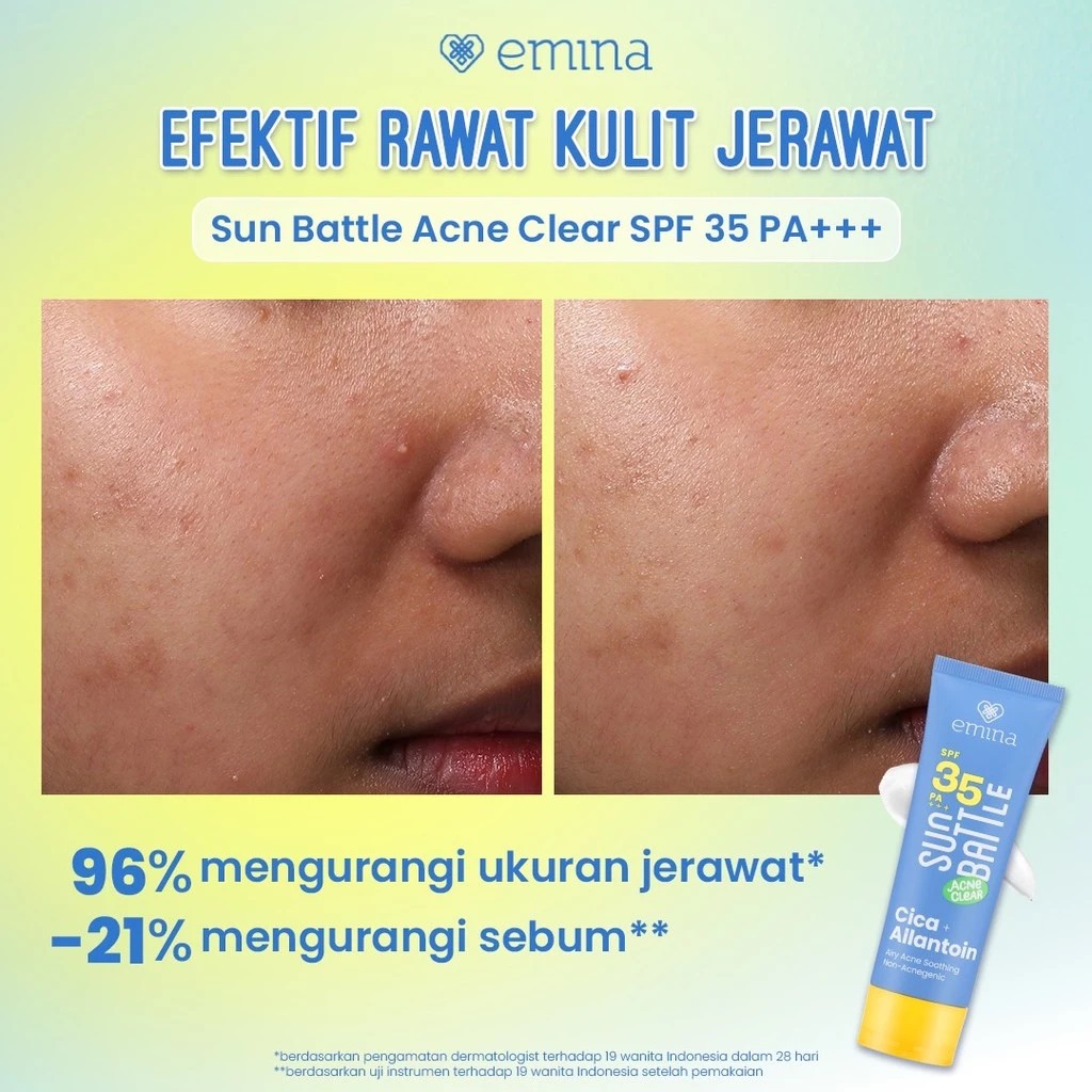 Emina Sun Battle Acne Clear Cica + Allantoin SPF35 PA+++ 50ml