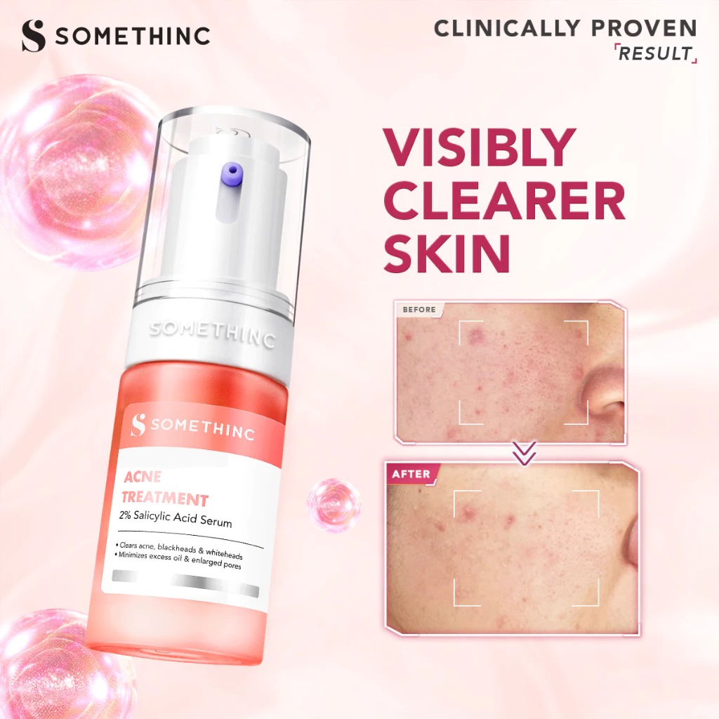 (NEW) Somethinc Acne Treatment 2% Salicylic Acid Serum Skin Booster 20ml