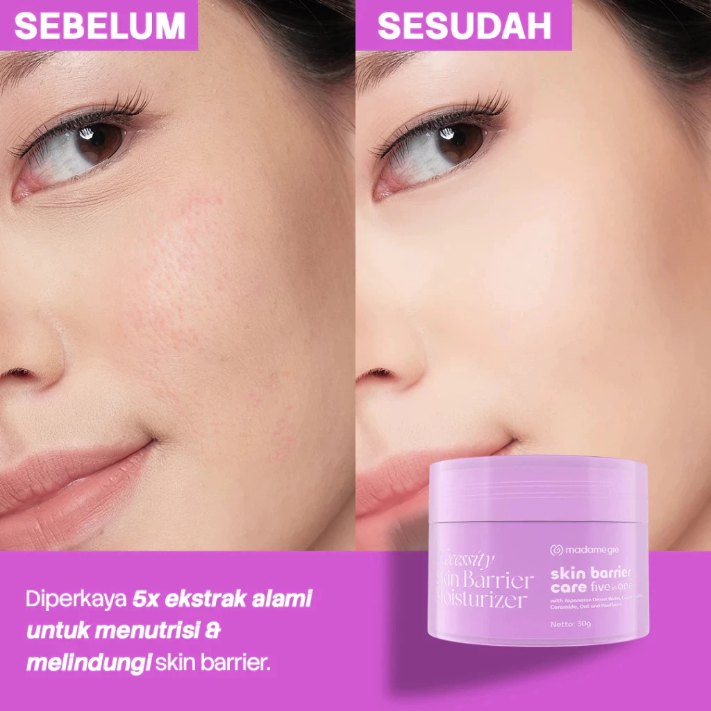 Madame Gie Necessity Skin Barrier Moisturizer 30gr