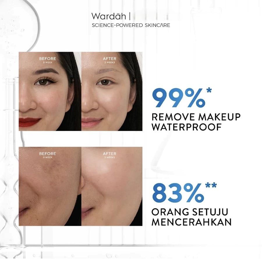 Wardah Lightening Oil-Infused Micellar Water 100ml Wardah Lightening Oil-Infused Micellar Water 100ml