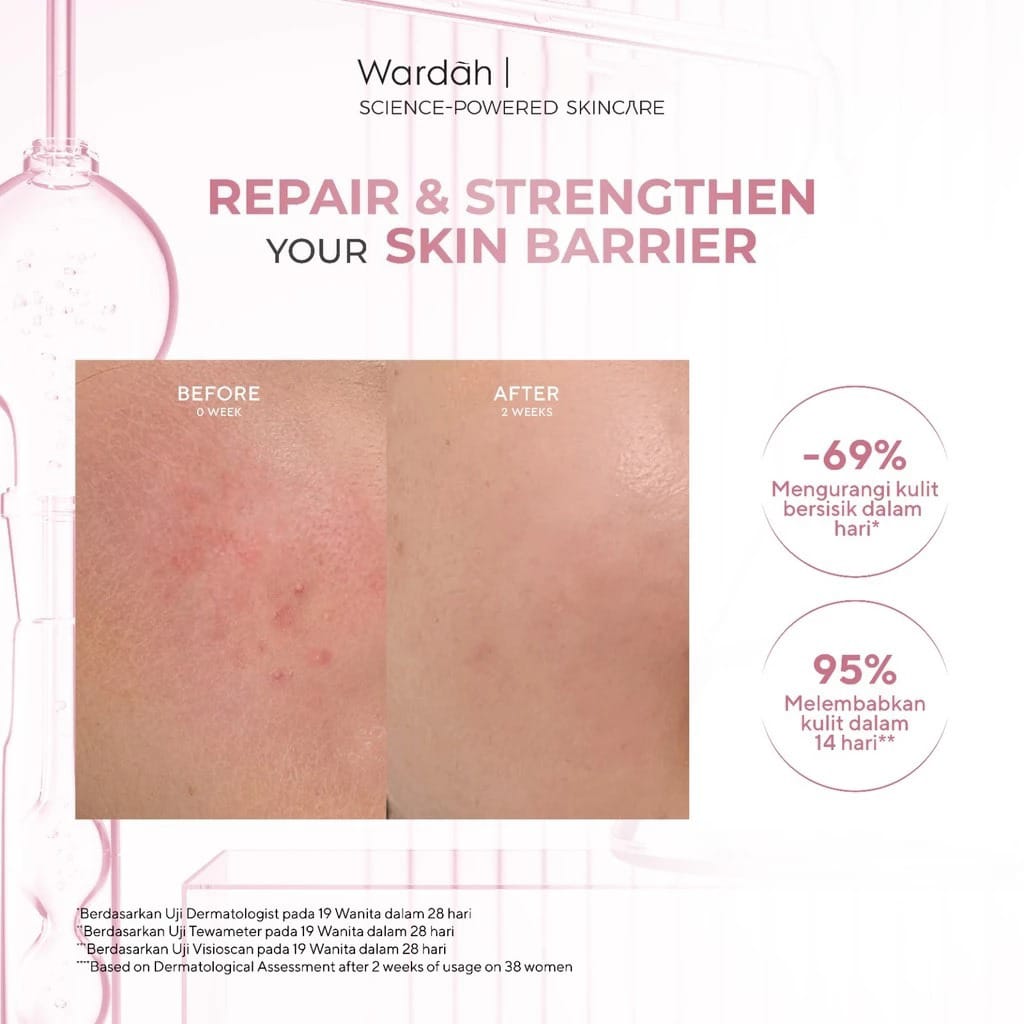 Wardah Hydra Rose 14X Hyaluron Pentavitin Deep Barrier Serum 30ml