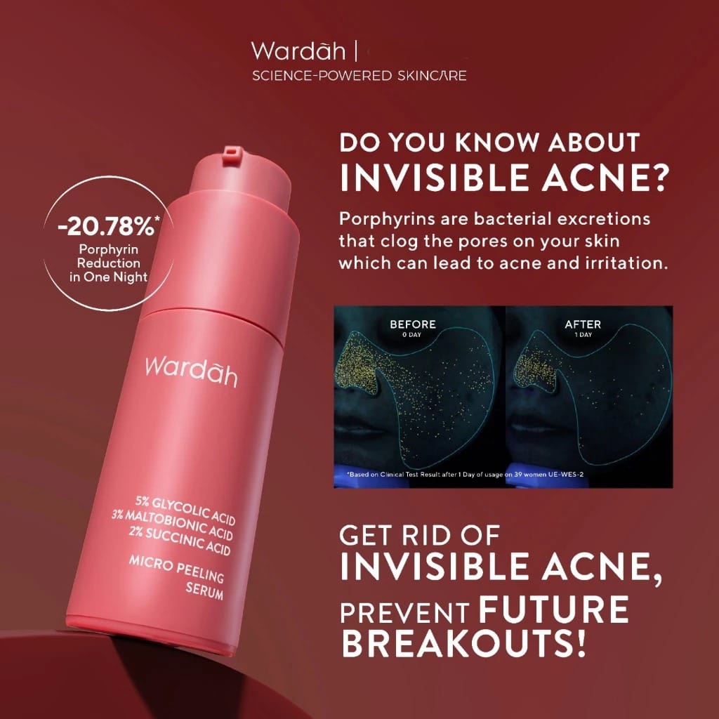 Wardah 5% Glycolic Acid + 3% Maltobionic Acid + 2% Succinic Acid Micro Peeling Serum 20ml