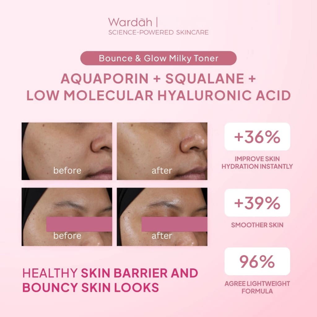 Wardah Aquaporin Squalane Bounce & Glow Milky Toner 95ml