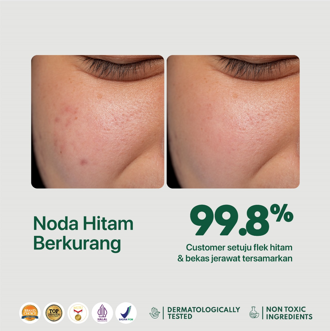 Npure Cica Dark Spot 5ml