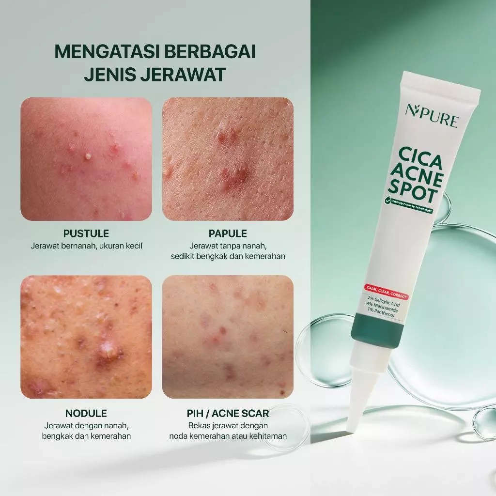 Npure Cica Acne Spot 20gr