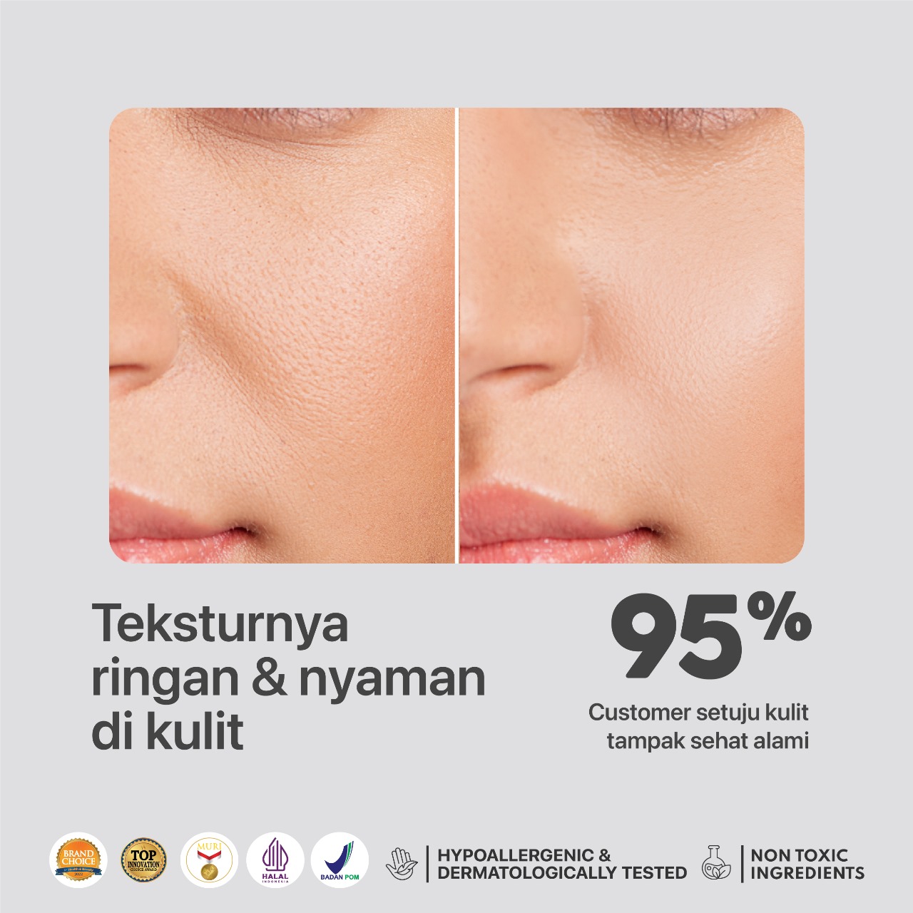 Npure Noni Probiotics Comfort Me Moisturizer 30ml