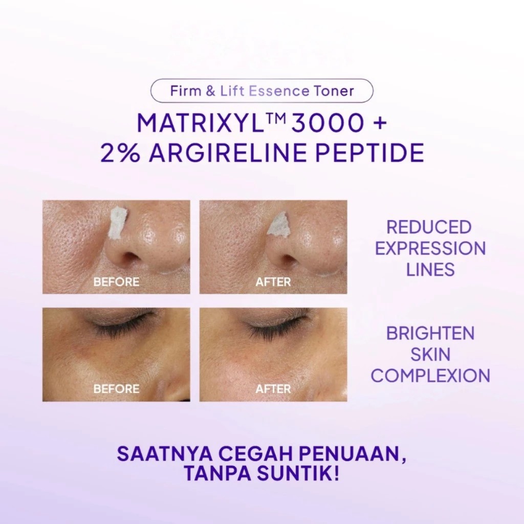 Wardah Renew You Argireline Peptide Matrixyl 3000 Firm & Lift Essence Toner 50ml