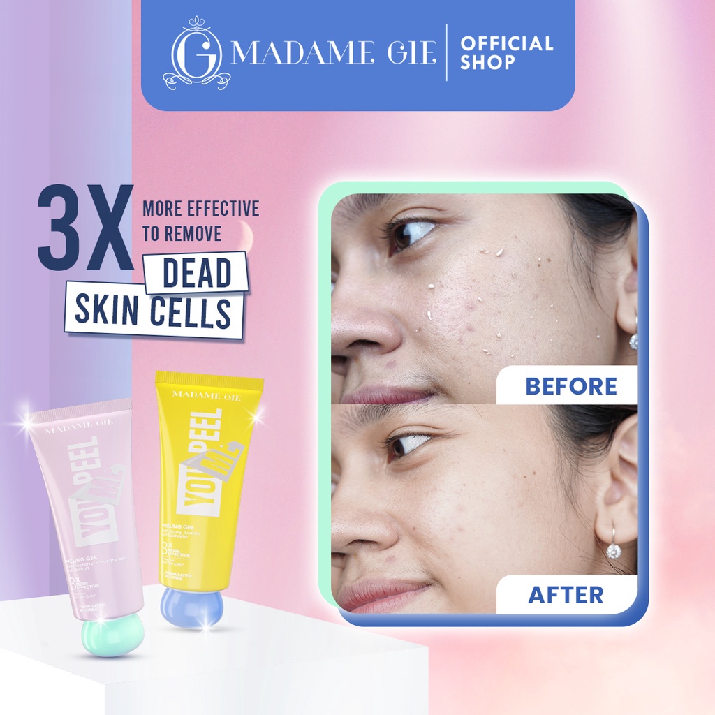 Madame Gie You Peel Me Cleanser 100gr - 01 Blueberry (Pink) Madame Gie You Peel Me Cleanser 100gr - 01 Blueberry (Pink)
