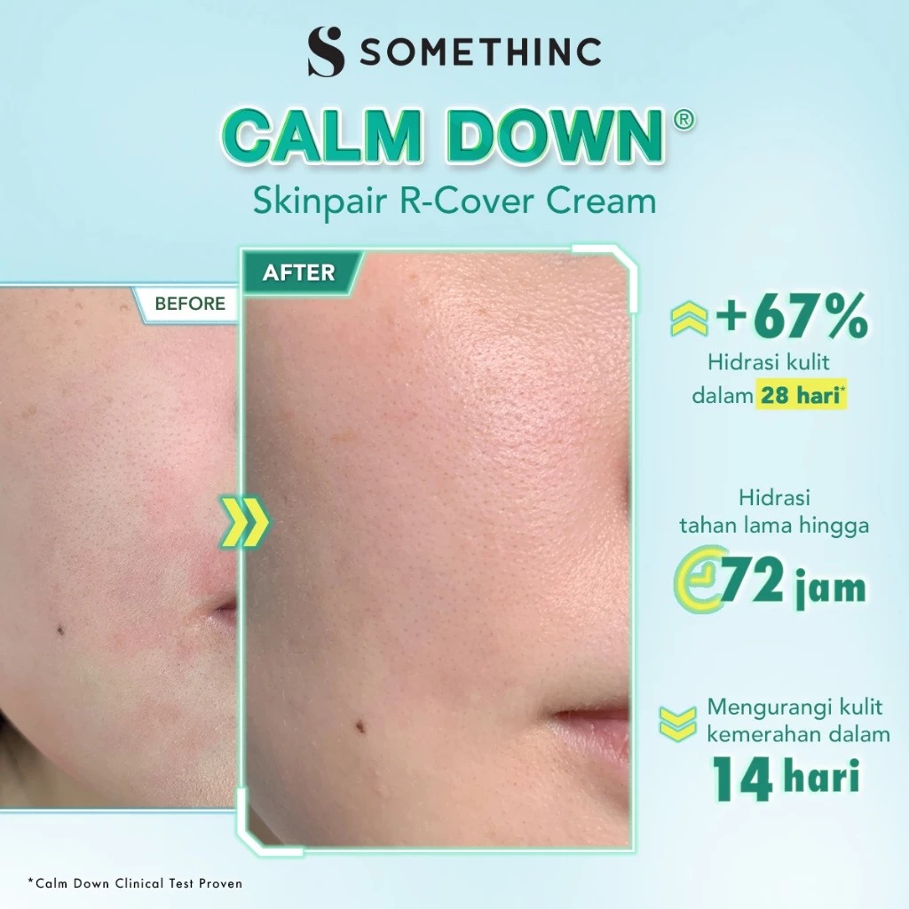 Somethinc Calm Down Skinpair R-Cover Cream 25ml