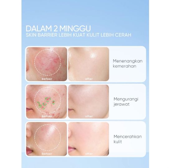 Skintific Ectoin Skin Cream Gel Moisturizer 30gr